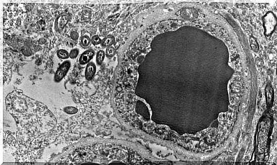 Brain microbiome: intestinal bacteria in the human brain