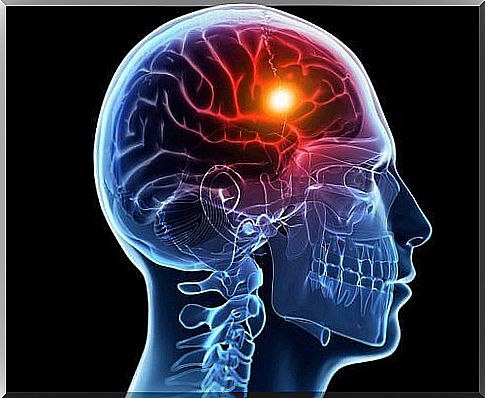 What are the causes and types of strokes?